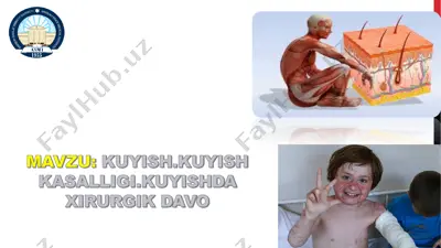 kuyishlar va ularga iqtisodiy ta'sir — PDF