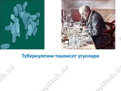 туберкулезни ташхисот усуллари — PPTX