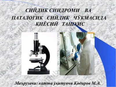 сийдик синдроми ва патологик сийдик чўкмасида қиёсий ташхис — PPT