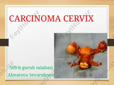 carcinoma cervix — PPT