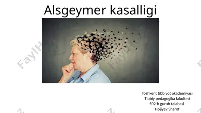 altsgeymer kasalligi — PPTX