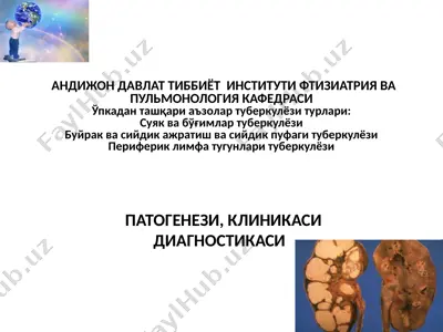 ўпкадан ташқари аъзолар туберкулёзи: патогенези, клиникаси ва диагностикаси — PPTX