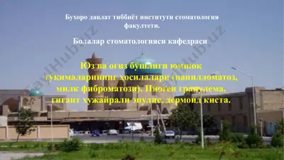 юз ва оғиз бўшлиғи юмшоқ тўқималарининг ҳосилалари (папилломатоз, милк фиброматози, пиоген гранулема, гигант ҳужайрали эпулис, дермоид киста) — PPTX