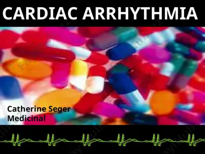 cardiac arrhythmia — PPT