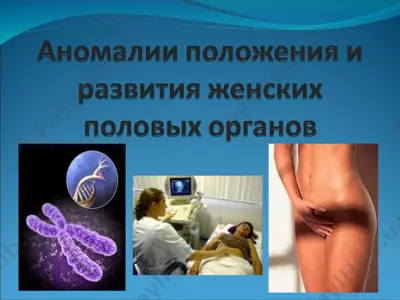 правильное положение половых органов — PPT