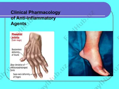 clinical pharmacology of anti-inflammatory agents (rheumatic diseases) — PPT