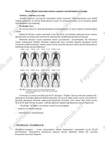 ilbiz kanalini apikal-koranal kengaytirish usullari — DOCX