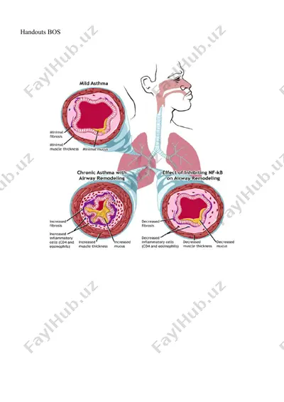 management and treatment of patients with broncho-obstructive syndrome — DOCX