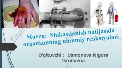 shikastlanish natijasida organizmning umumiy reaksiyalari — PPTX