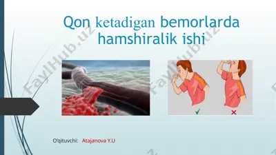 qonketadigan bemorlardan ham shiralikishi — PPTX