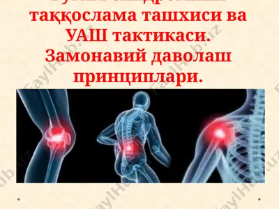 буғим синдромини таққослама ташхиси ва уаш тактикаси. замонавий даволаш принциплари. — PPTX