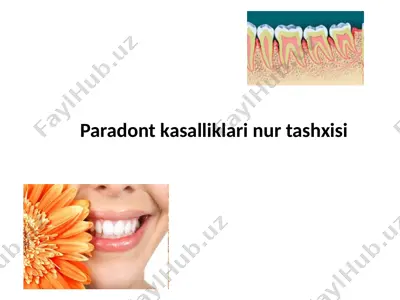 paradont kasalliklari nur tashxisi — PPTX