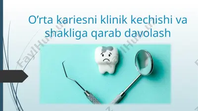o'rtakariesning sabablari — PPTX