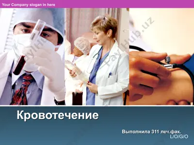 кровотечение — PPT