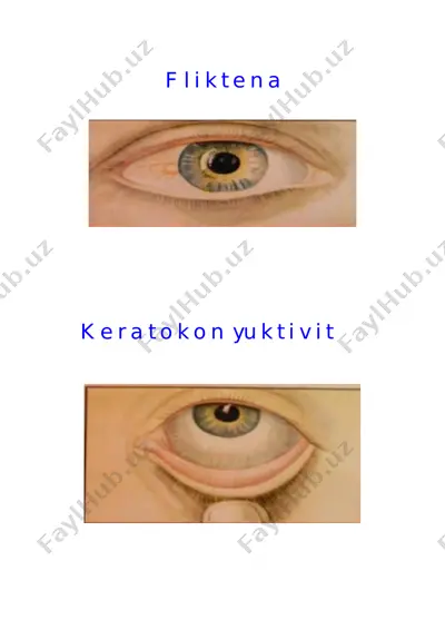 sil xastaligida rengenologik o‘zgarishlari bayonnomasi — PDF