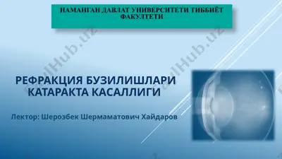 рефракция бузилишлари катаракта касаллиги — PPTX