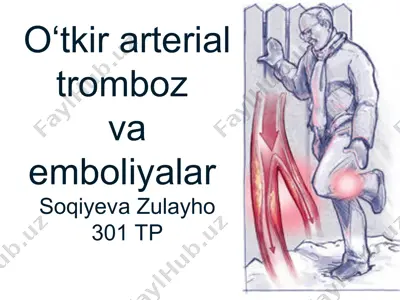 o‘tkir arterial tromboz va emboliyalar — PPT
