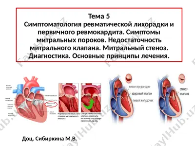 simptomatologiya revmaticheskoy lixoradki va pervichnogo revmokardita — PPTX
