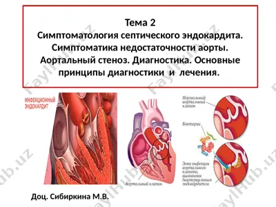 бактериальный септический эндокардит, определение — PPTX