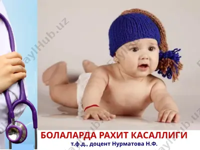 болаларда рахит касаллиги — PPTX