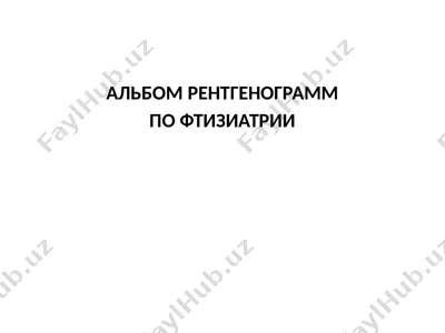 x-ray albumi tuberkulezga bo'lgan kasalliklarni aniqlash uchun — PPTX