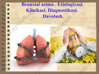 bronxialastma etiologiyasi,patogenezi,davolash — PPTX