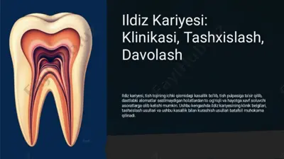 ildiz kariesini tashxislash va davolash — PDF