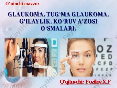 glaukoma. tug'ma glaukoma. g'ilaylik. ko'ruv a'zosi o'smalari. — PDF