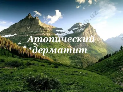 атопический дерматит — PPT