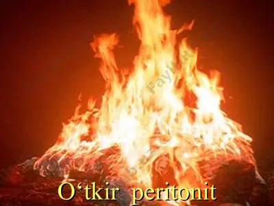 o‘tkir peritonit — PPT