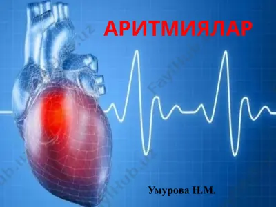 аритмиялар — PPTX