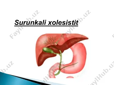 surunkalixolesistit — PPTX