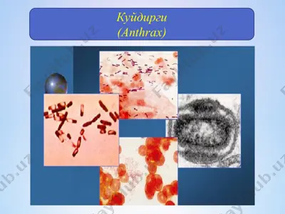 куйдирги (anthrax) — PPT