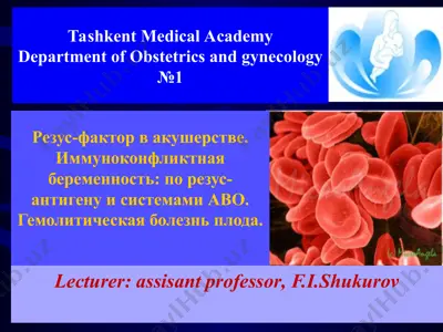 резус-фактор в акушерстве. иммуноконфликтная беременность — PPT