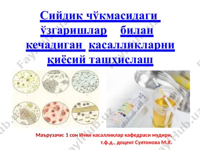 сийдикчўкмасидагиўзгаришлар биланкечадиганкасалликларни қиёсийташҳислаш — PPTX