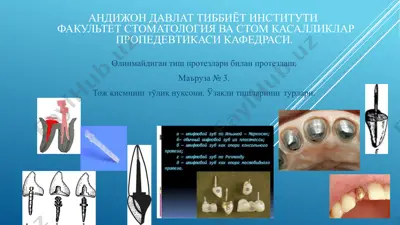 olinmagan tish protezlarining prostezlash (маъруза № 3) — PPTX