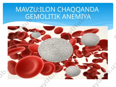 ilon chaqqanda  gemolitik anemiya — PPTX