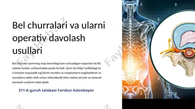 belchurralar va uvularni operativ davolash usullari — PPTX