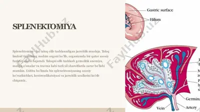 splenektomiya — PPTX