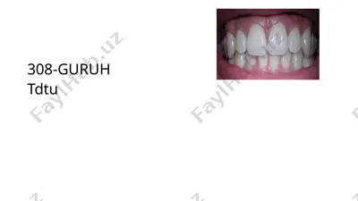 tishnuqsonlarining xalqaro tasnifi — PPTX