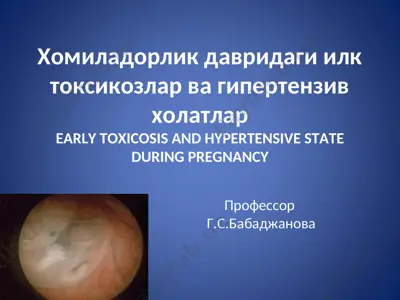 xomiladorlik davridagi ilk toksikozlar va gipertenziv xolatlar (early toxicosis and hypertensive state during pregnancy) — PPT