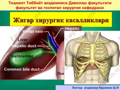 jigar xirurgik kasalliklari — PPT