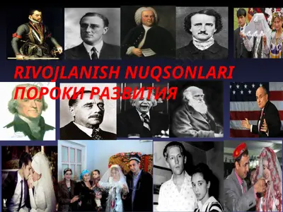 rivojlanish nuqsonlari — PPT