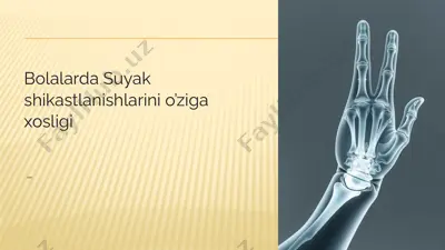 bolalarda suyakshikastlanishlarinio’zigaxosligi — PPTX