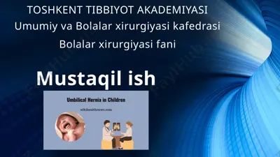 umbilical hernia in children — PPTX