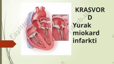 yurak miokardinfarkti — PPTX
