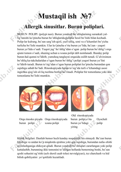 burun polipi — DOCX