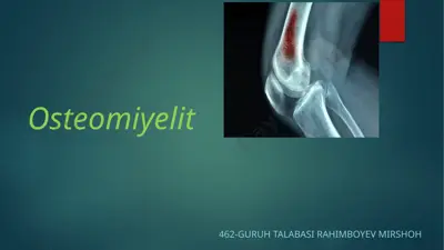 osteomiyelit — PPTX