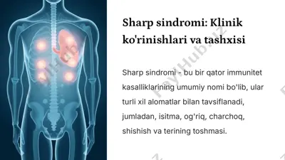 sharp sindromi: klinik ko'rinishlari va tashxisi — PPTX