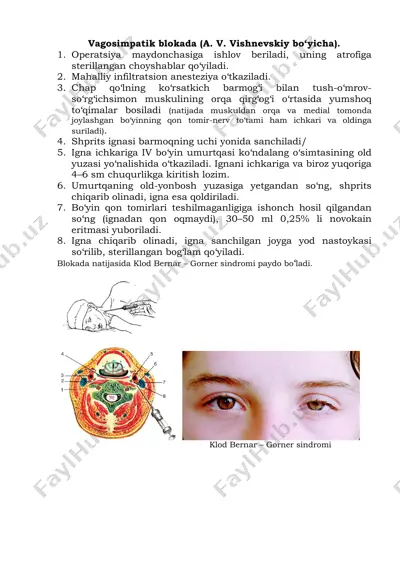 vagosimpatik blokada (a. v. vishnevskiy bo‘yicha) — PDF